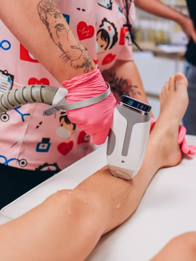 Triệt lông công nghệ laser có đau không